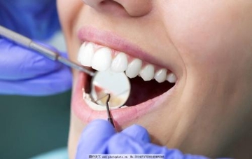 改良横腭杆压低上颌第二磨牙1例